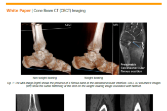 Carestream CBCT Weight Bearing Images