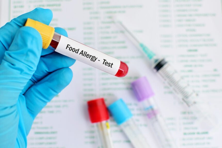 food allergy test