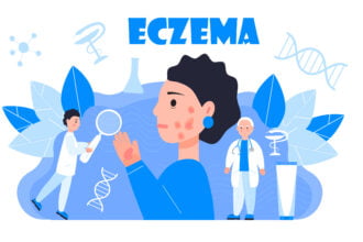 how to treat eczema