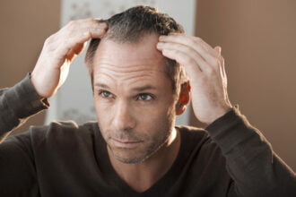 hair loss technology