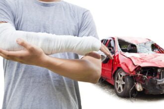 A Guide to Securing Your Long-Term Health After a Car Accident preview