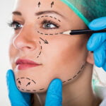 Surgeon Drawing Lines On Woman's Face For Plastic Surgery