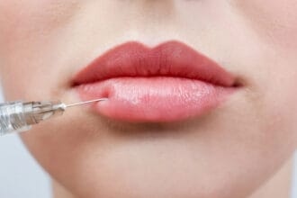 lip fillers and mental health