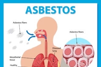 Understanding the Connection Between Asbestos and Mesothelioma